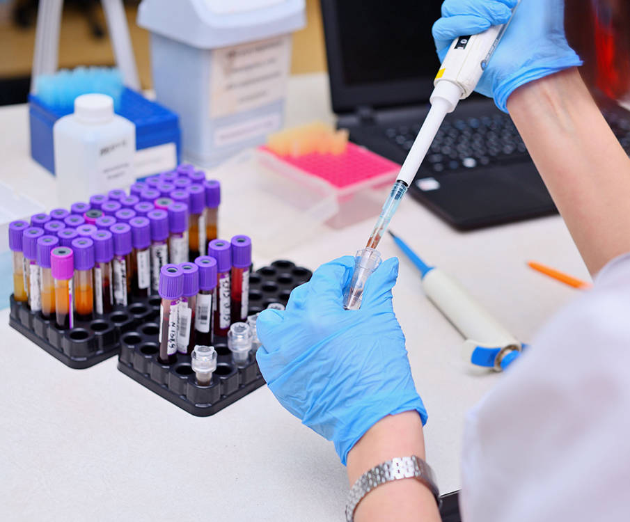 Kummikinnastega laborant kasutab vereanalüüsist proovide võtmisel pipetti